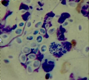 Fungo Sporothrix sp, causador da esporotricose.